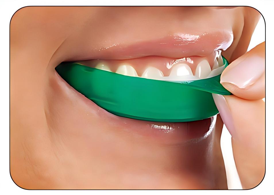 Teeth Whitening Opalescence Go - Bandes blanchissantes pour les dents Ultradent