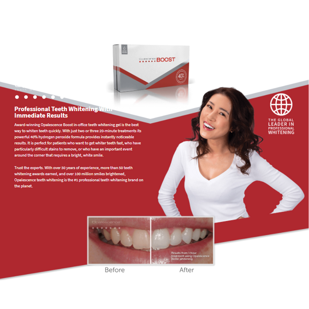 Opalescence Boost 40% PF Ameri - Teeth Whitening Opalescence avis et prix