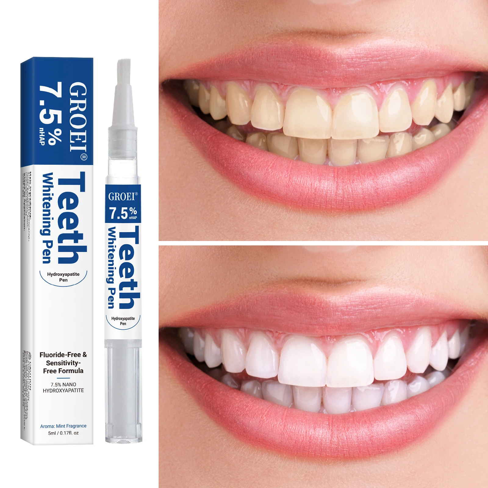 Stylo de blanchiment des dents - Teeth Whitening Remedies avis et prix