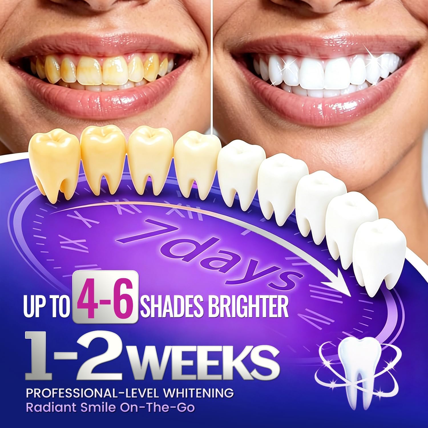 7 paires de bandes blanchissan - Teeth Whitening Retainer avis et prix
