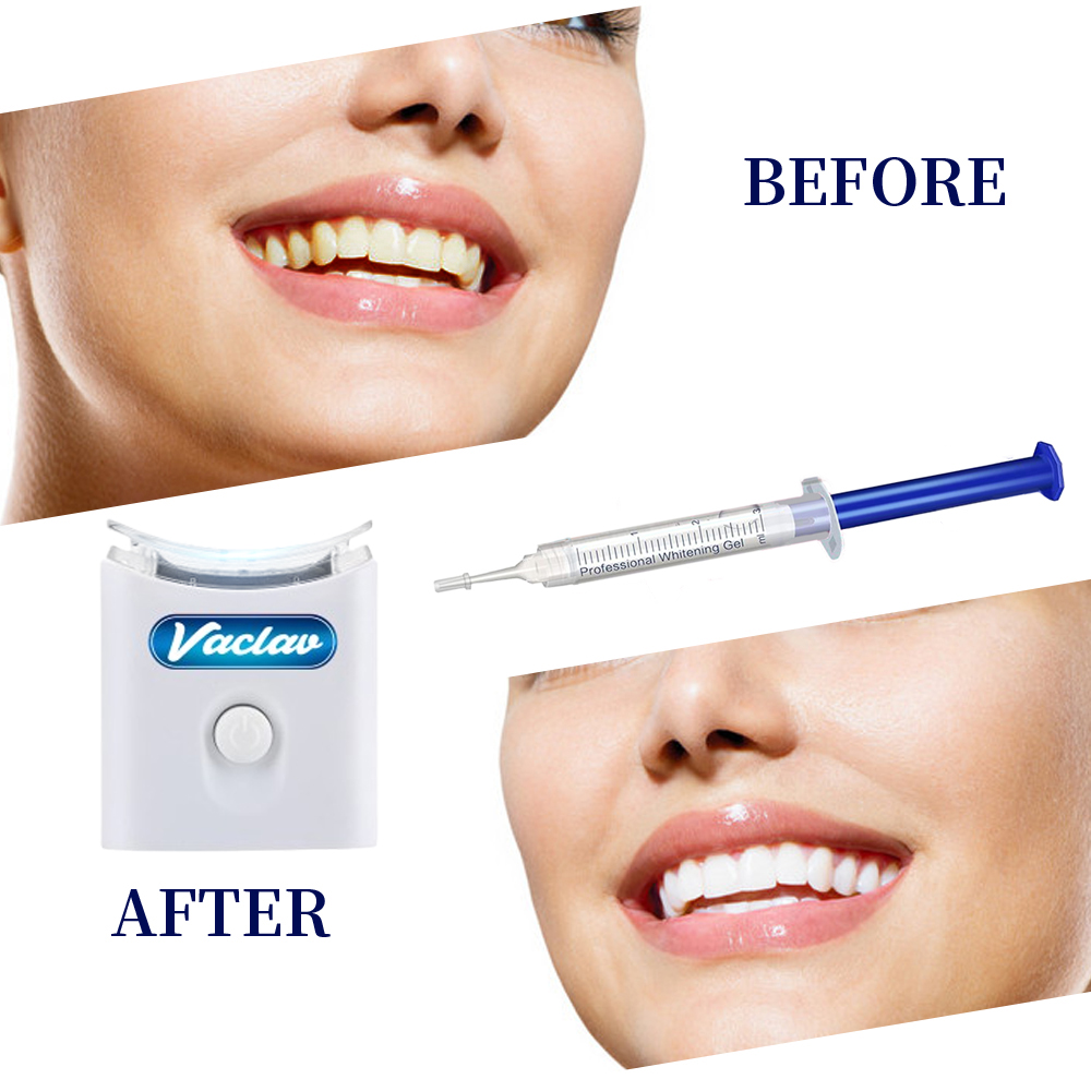 Seringue de Gel de blanchiment - Teeth Whitening Opalescence avis et prix