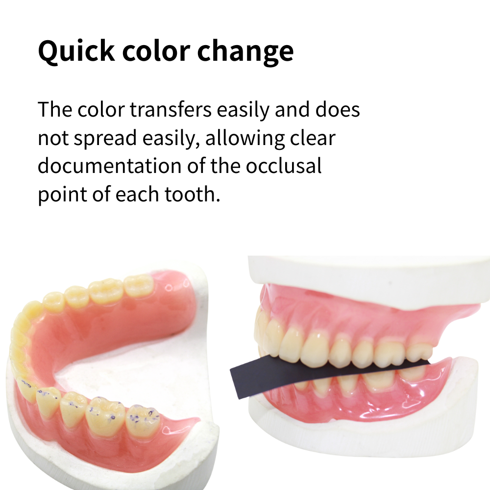 Bandes de papier articulatrice - Teeth Whitening Retainer avis et prix