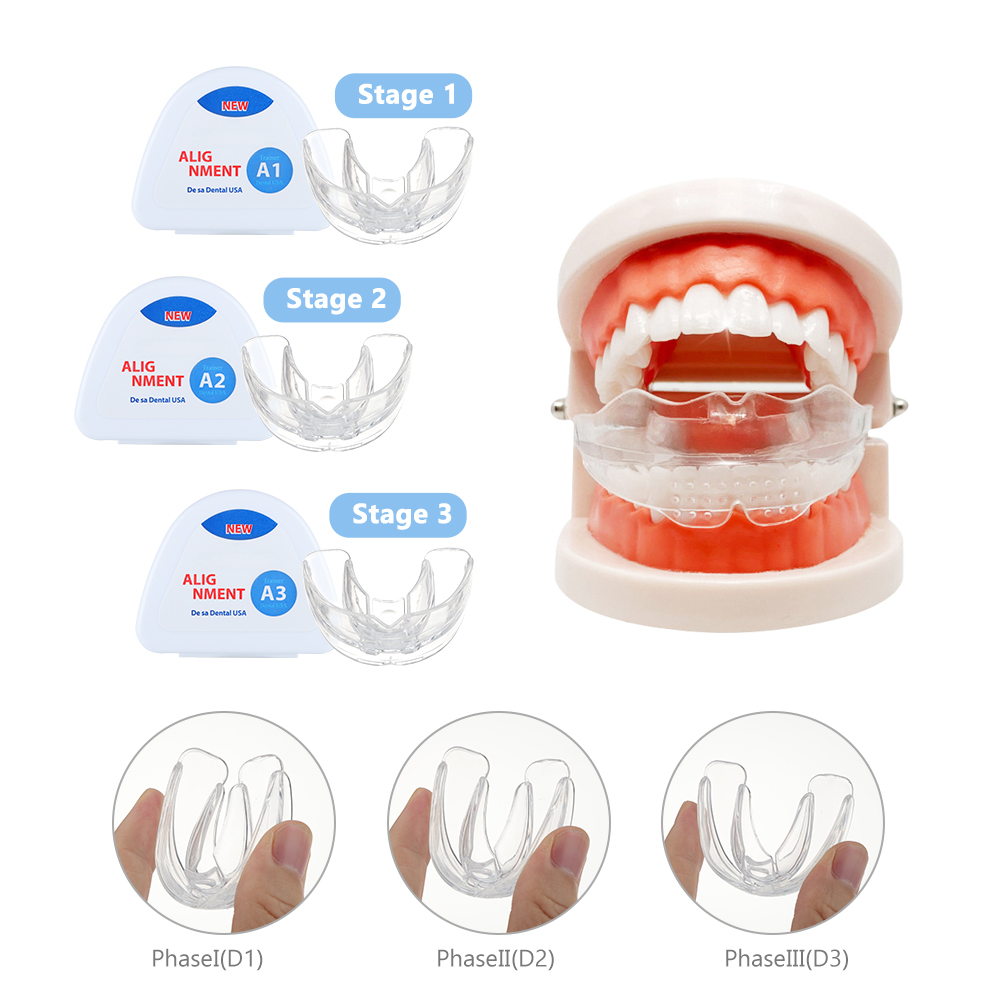 Ensemble de bretelles orthodon - Teeth Whitening Retainer avis et prix
