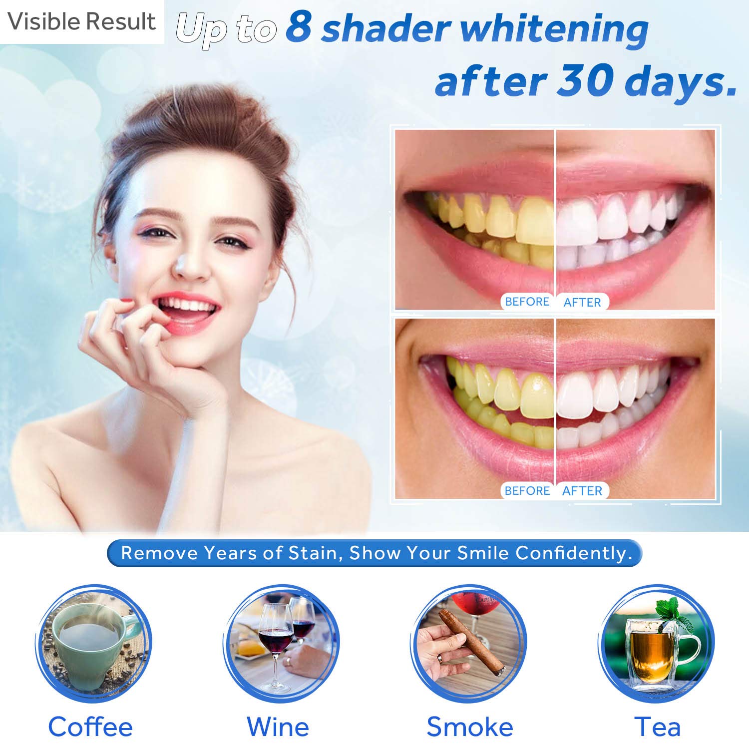 Gel de blanchiment des dents r - Teeth Whitening Opalescence avis et prix