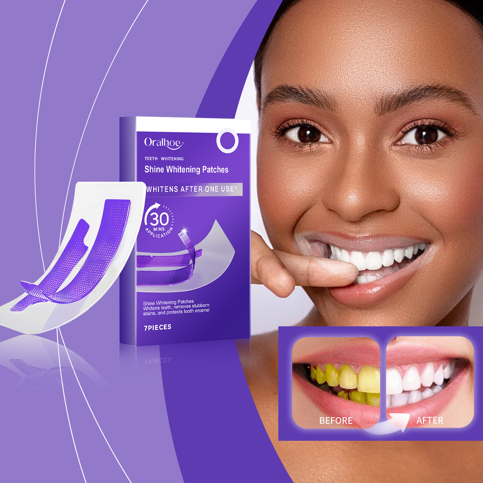 Bandes blanchissantes pour les - Teeth Whitening Retainer avis et prix