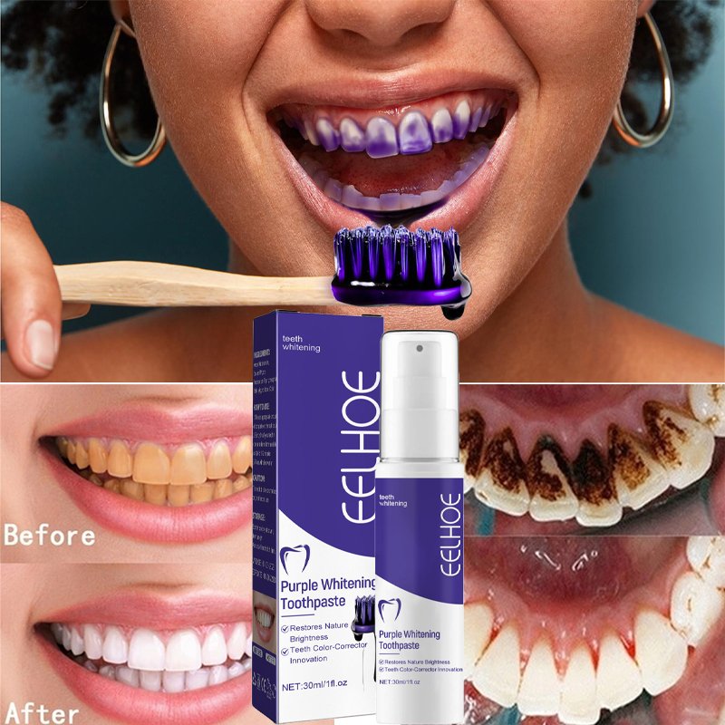 Dentifrice blanchissant pour l - Teeth Whitening In Korea avis et prix