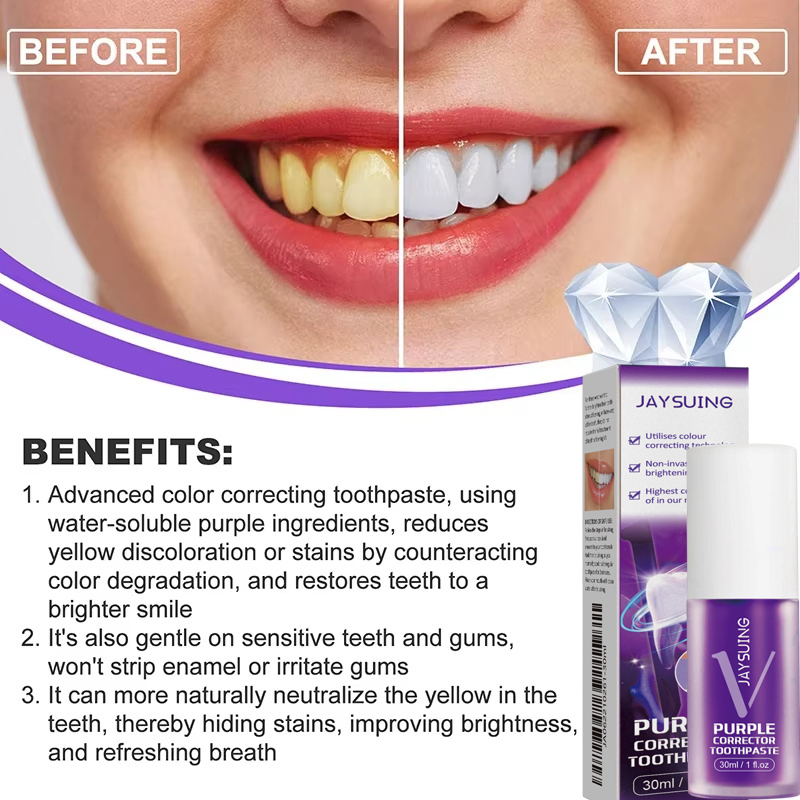 Dentifrice blanchissant pour l - Teeth Whitening In Korea avis et prix