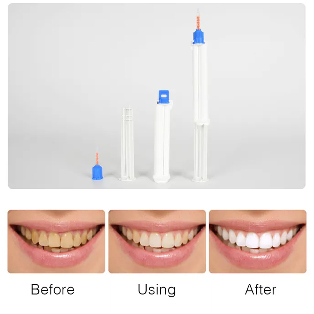 Seringue dentaire à double bar - Teeth Whitening Opalescence avis et prix