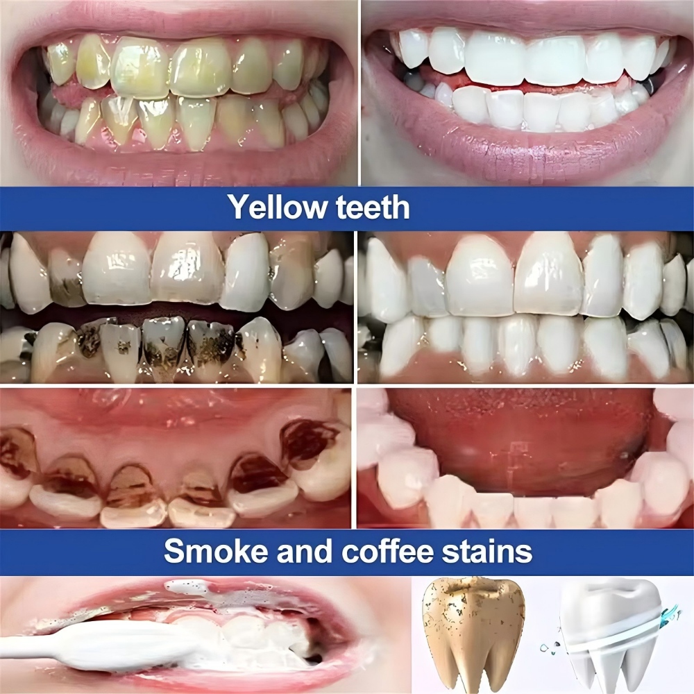Poudre de blanchiment des dent - Teeth Whitening Powder avis et prix