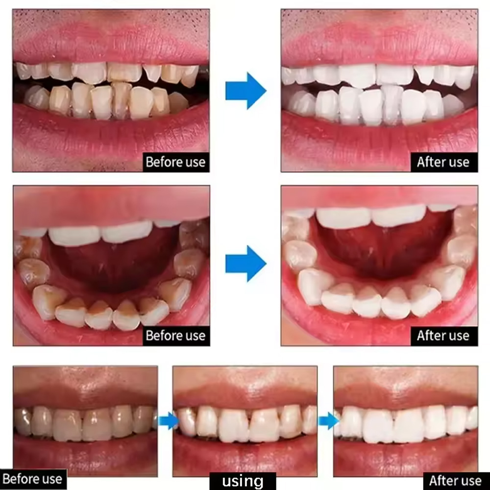 Poudre de blanchiment des dent - Teeth Whitening Powder avis et prix