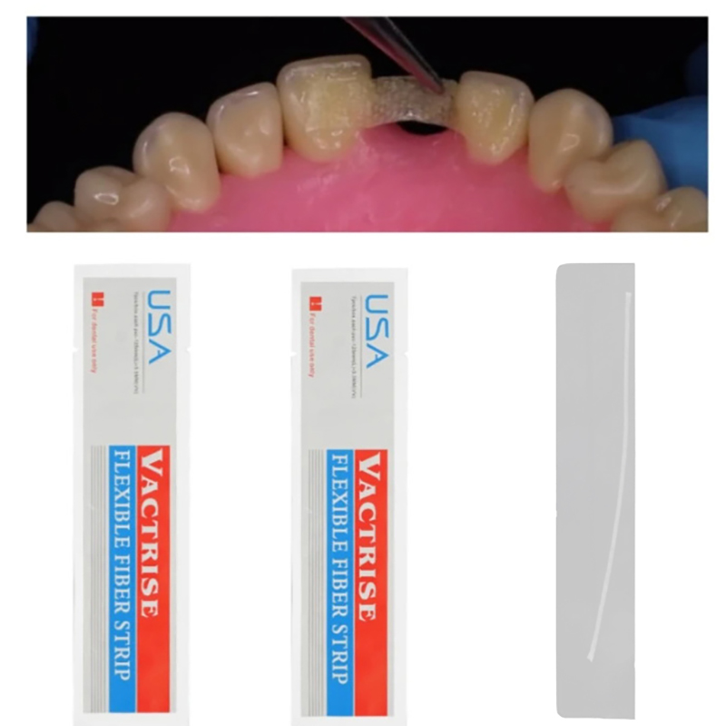 1 pièce Bande de fibre dentair - Teeth Whitening Retainer avis et prix